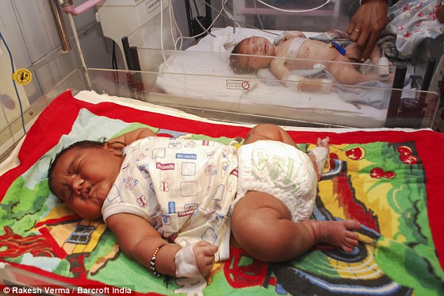 インド最大の赤ちゃんが誕生！！その大きさは約６キロ！